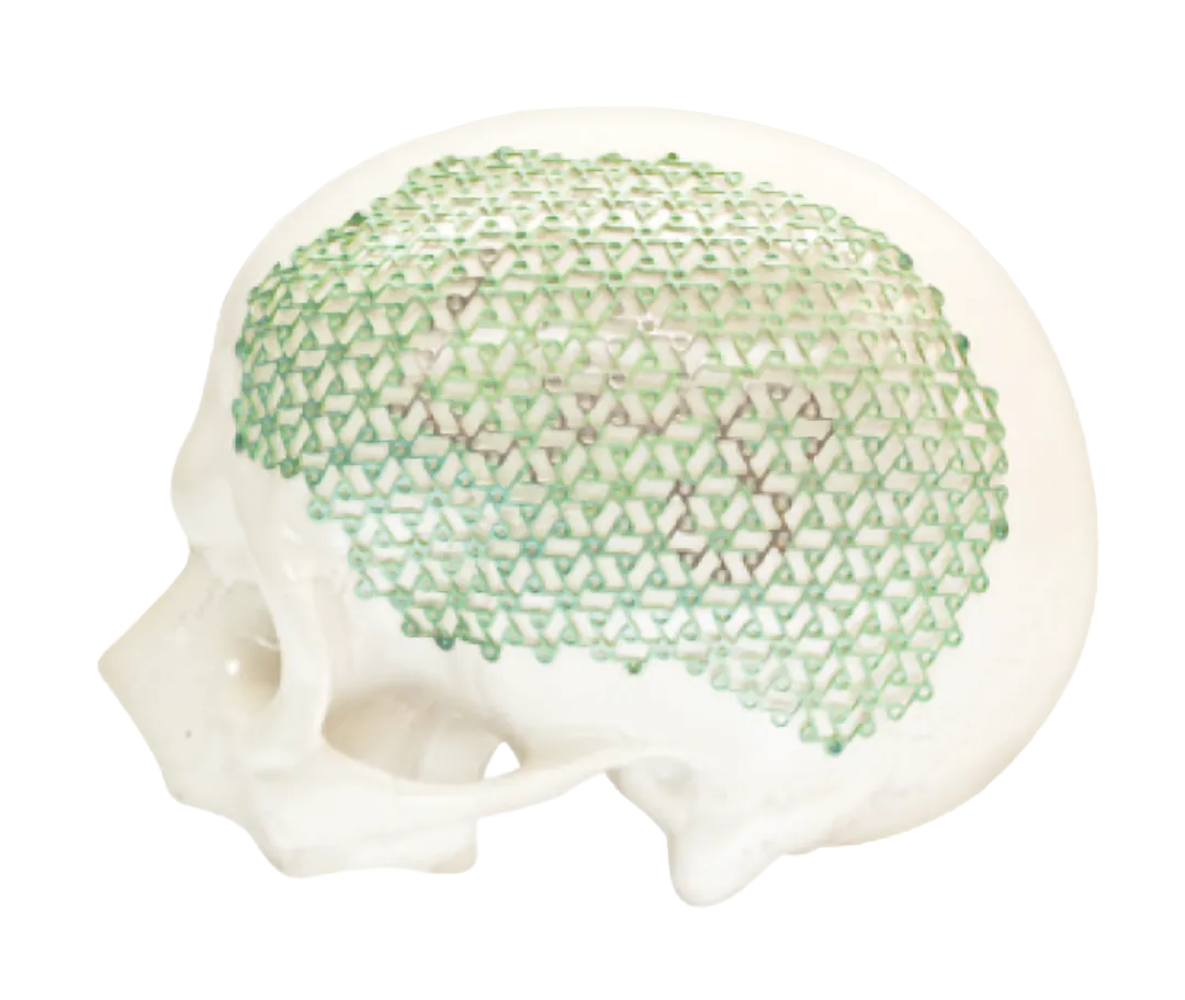foto del sistema craniocurve para craeoplastia marca zimmer biomet